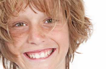 Higiene bucal adolescentes