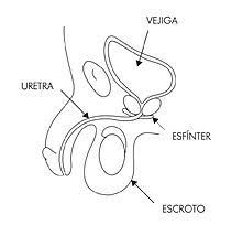 Incontinencia urinaria