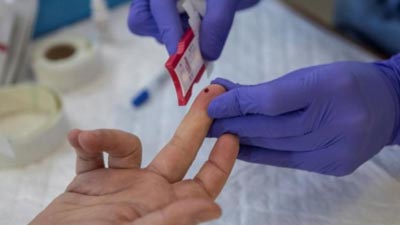 Test serológico anticuerpos