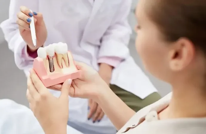 Servicios implantología dental en Cádiz