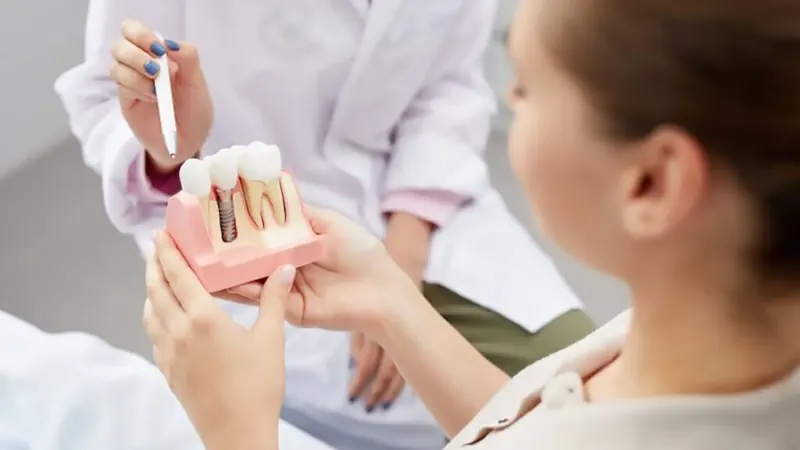 Servicios implantología dental en Cádiz